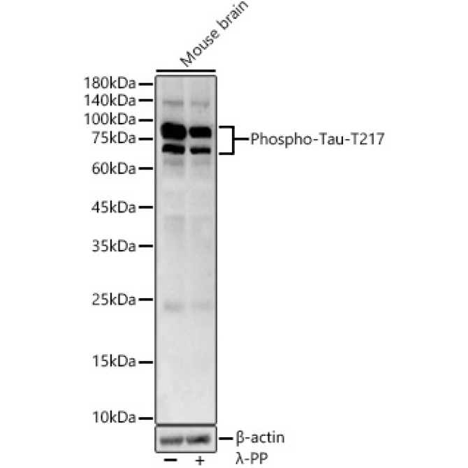 Phospho-Tau-T217 Rabbit Polyclonal Antibody