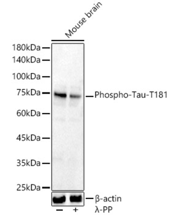 Phospho-Tau-T181 Rabbit Polyclonal Antibody