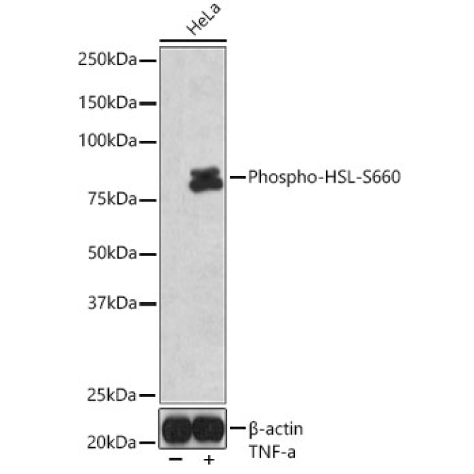 Phospho-HSL-S660 Rabbit Polyclonal Antibody