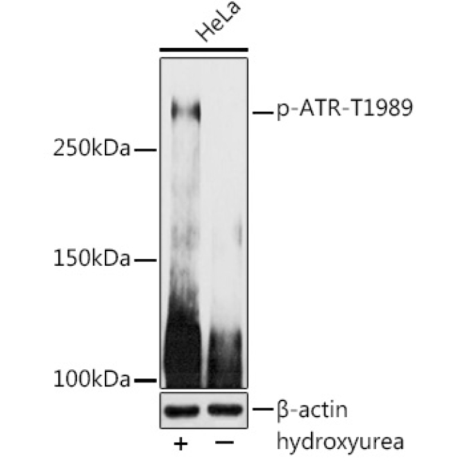 Phospho-ATR-T1989 Rabbit Polyclonal Antibody