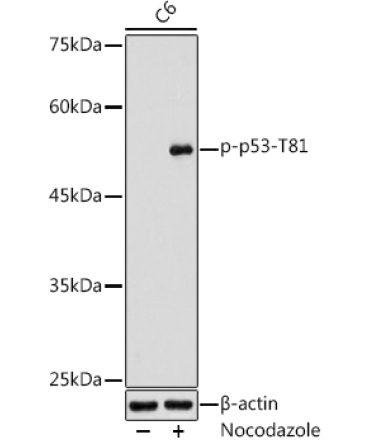 Phospho-p53-T81  Rabbit Polyclonal Antibody