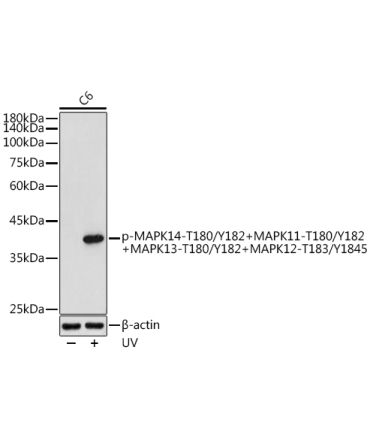 Phospho-MAPK14-T180/Y182+MAPK11-T180/Y182+MAPK13-T180/Y182+MAPK12-T183/Y1845  Rabbit Polyclonal Antibody