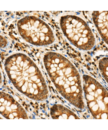 Phospho-RIP3-S227 Rabbit Polyclonal Antibody