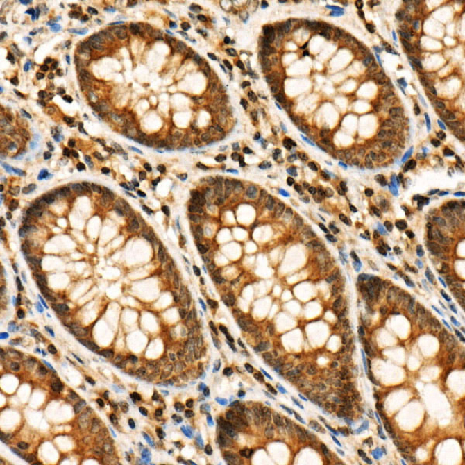 Phospho-RIP3-S227 Rabbit Polyclonal Antibody