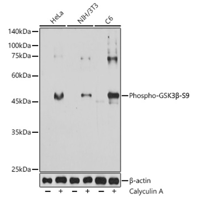 Phospho-GSK3Beta-S9 Mouse Monoclonal Antibody