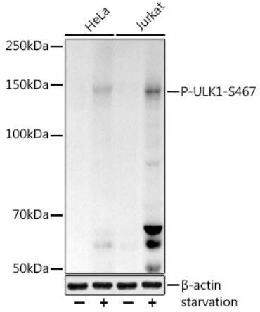 Phospho-ULK1-S467 Rabbit Polyclonal Antibody