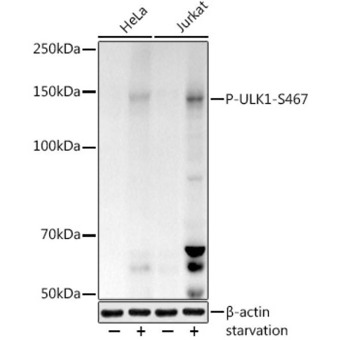Phospho-ULK1-S467 Rabbit Polyclonal Antibody