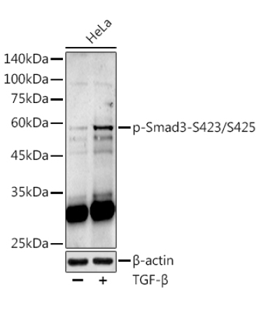 Phospho-Smad3-S423/S425 Rabbit Polyclonal Antibody