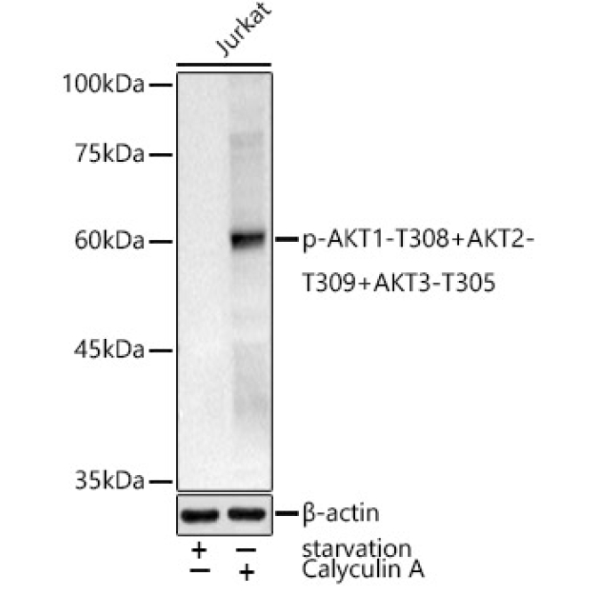 Phospho-AKT1-T308+AKT2-T309+AKT3-T305 Rabbit Polyclonal Antibody