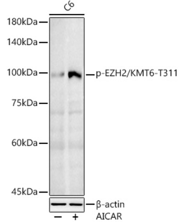 Phospho-EZH2/KMT6-T311 Rabbit Polyclonal Antibody