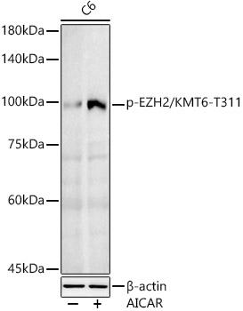 Phospho-EZH2/KMT6-T311 Rabbit Polyclonal Antibody