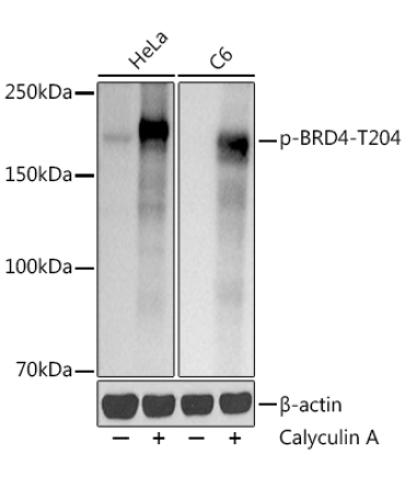 Phospho-BRD4-T204 Rabbit Monoclonal Antibody