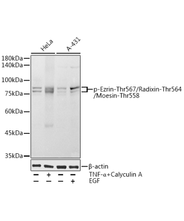 Phospho-Ezrin-Thr567/Radixin-Thr564/Moesin-Thr558 Rabbit Polyclonal Antibody