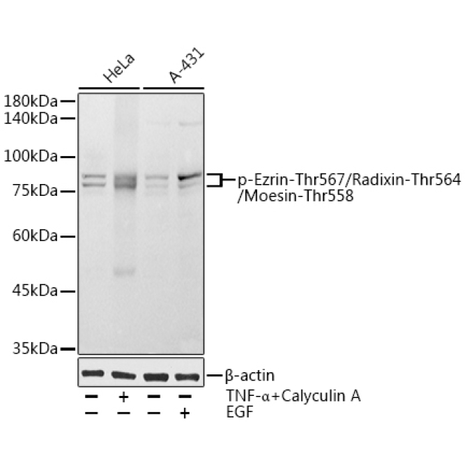 Phospho-Ezrin-Thr567/Radixin-Thr564/Moesin-Thr558 Rabbit Polyclonal Antibody