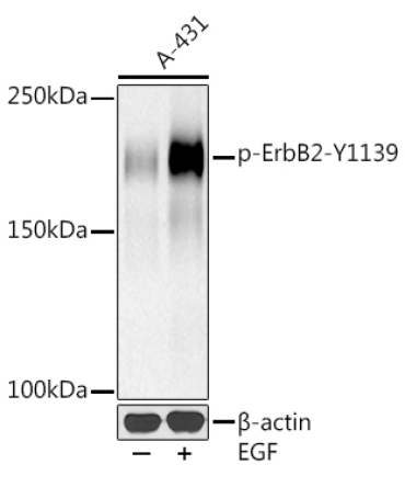 Phospho-HER2/ErbB2-Y1139 Rabbit Monoclonal Antibody
