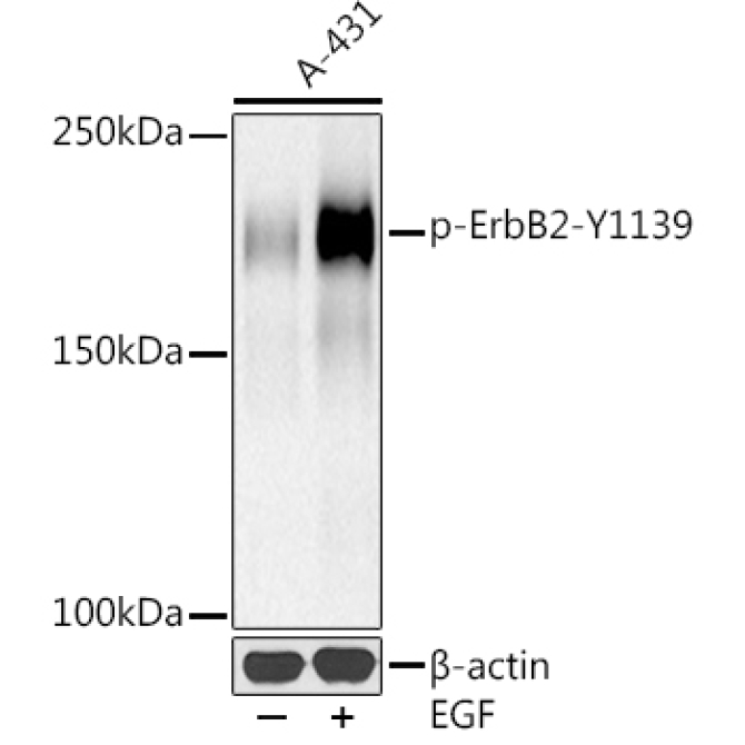 Phospho-HER2/ErbB2-Y1139 Rabbit Monoclonal Antibody