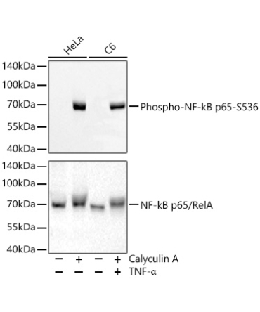 Phospho-NF-kB p65/RelA-S536 Rabbit Monoclonal Antibody