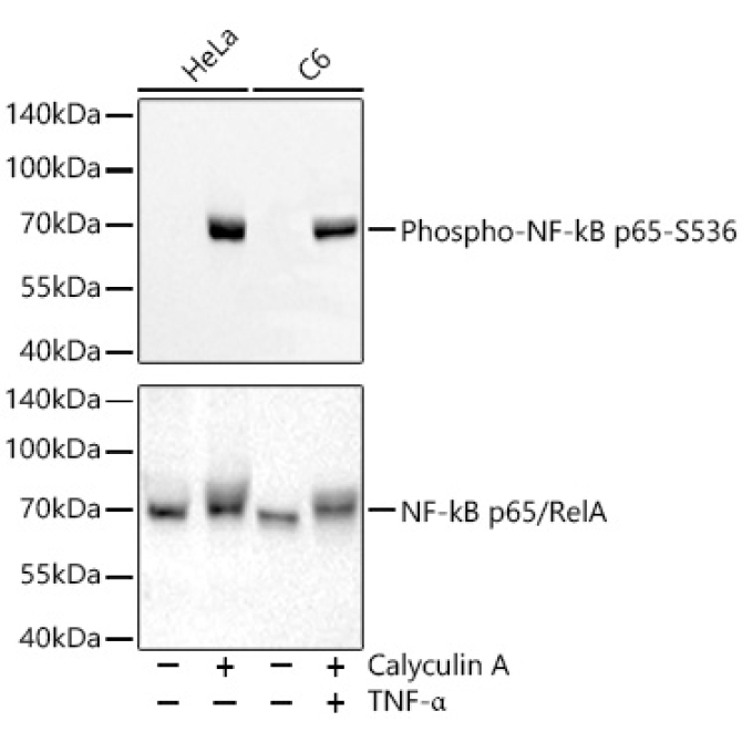 Phospho-NF-kB p65/RelA-S536 Rabbit Monoclonal Antibody