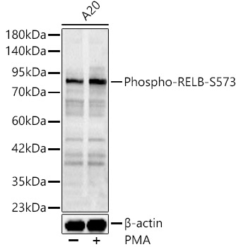 Phospho-RELB-S573 Rabbit Polyclonal Antibody