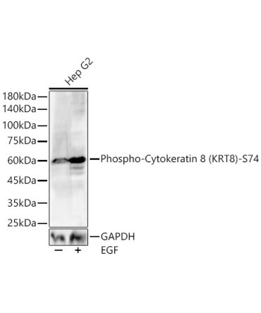 Phospho-Cytokeratin 8 (KRT8)-S74 Rabbit Polyclonal Antibody