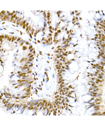 Phospho-MDM2-S166 Rabbit Monoclonal Antibody