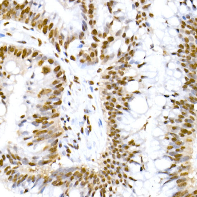 Phospho-MDM2-S166 Rabbit Monoclonal Antibody