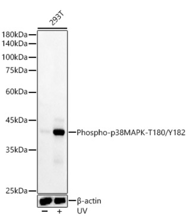 Phospho-p38 MAPK-T180/Y182 Rabbit Monoclonal Antibody