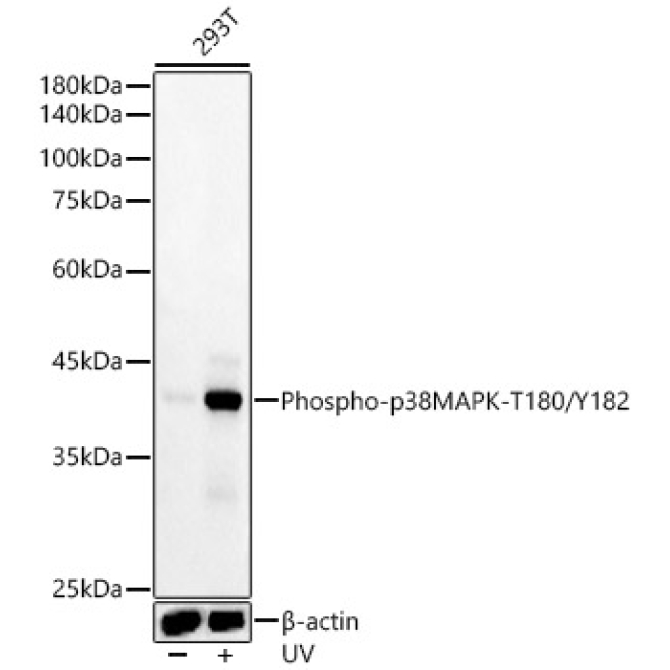 Phospho-p38 MAPK-T180/Y182 Rabbit Monoclonal Antibody