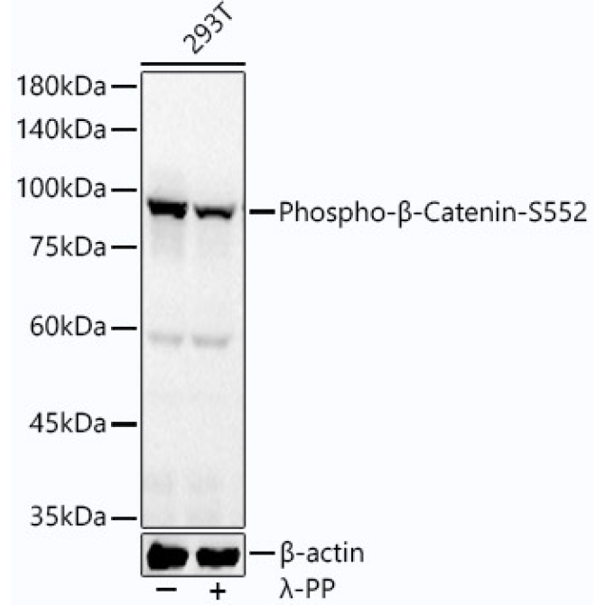 Phospho-Beta-Catenin-S552 Rabbit Monoclonal Antibody