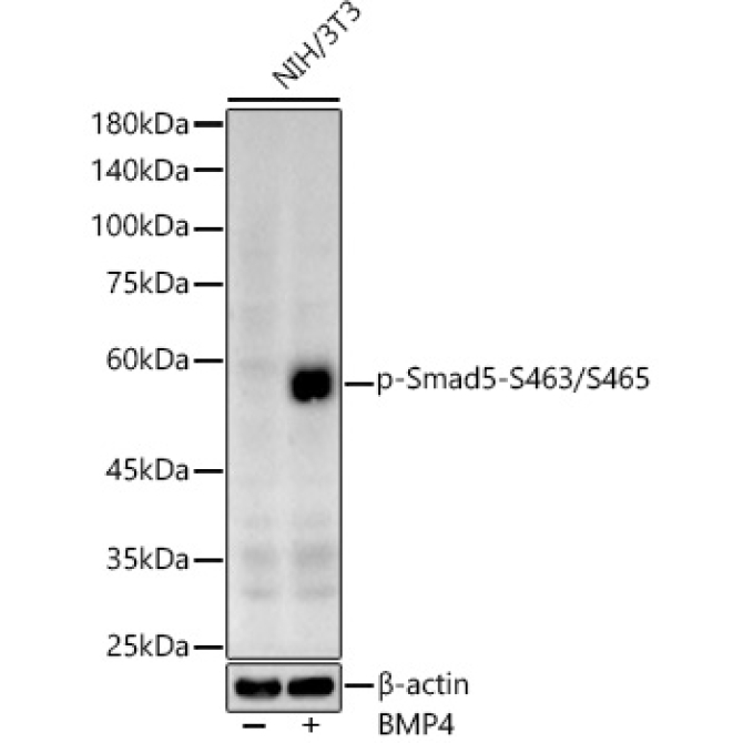 Phospho-Smad5-S463/S465 Rabbit Polyclonal Antibody
