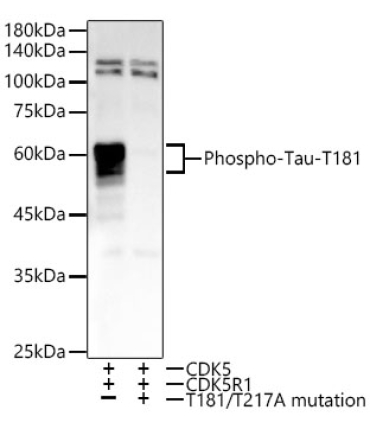 Phospho-Tau-T181 Rabbit Monoclonal Antibody