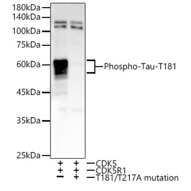 Phospho-Tau-T181 Rabbit Monoclonal Antibody