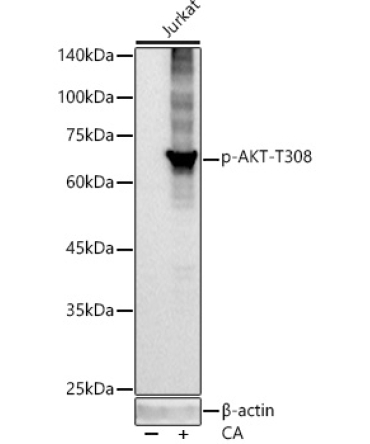 Phospho-Akt-T308 Rabbit Monoclonal Antibody