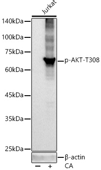 Phospho-Akt-T308 Rabbit Monoclonal Antibody