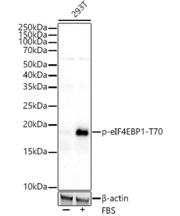 Phospho-eIF4EBP1-T70 Rabbit Monoclonal Antibody