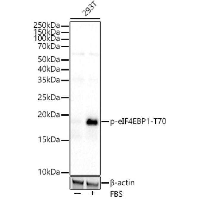 Phospho-eIF4EBP1-T70 Rabbit Monoclonal Antibody