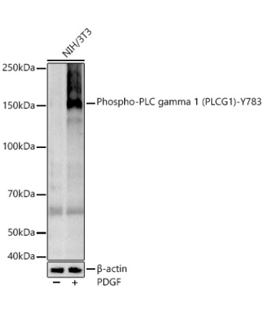 Phospho-PLC gamma 1 (PLCG1)-Y783 Rabbit Monoclonal Antibody