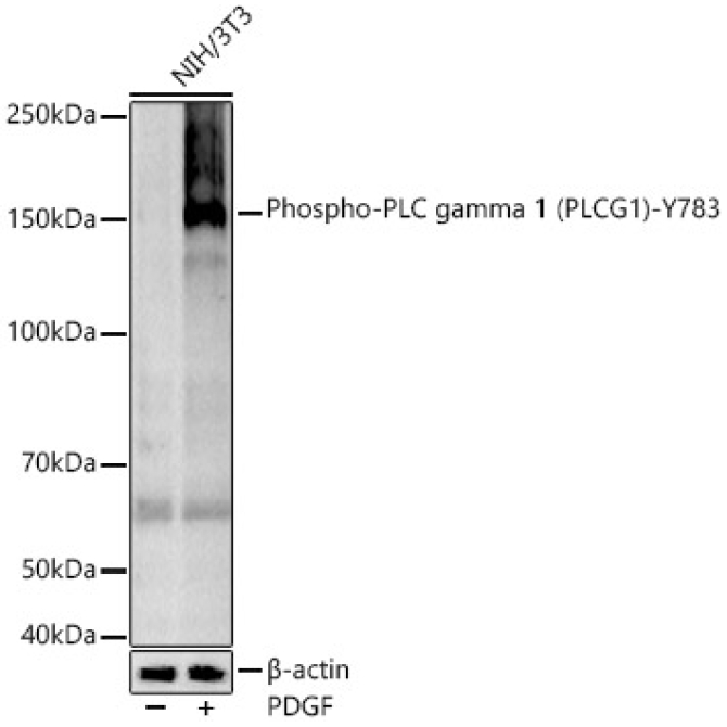 Phospho-PLC gamma 1 (PLCG1)-Y783 Rabbit Monoclonal Antibody