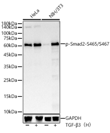 Phospho-Smad2-S465/S467 Rabbit Monoclonal Antibody
