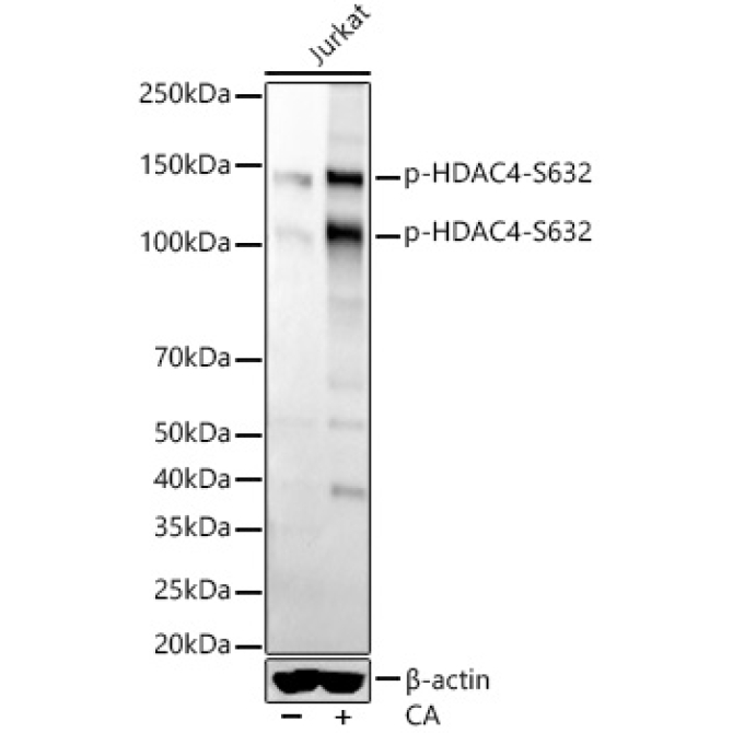 Phospho-HDAC4-S632 Rabbit Monoclonal Antibody
