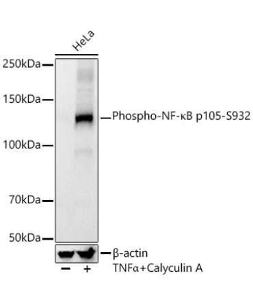 Phospho-NF-?B p105-S932 Rabbit Monoclonal Antibody