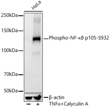 Phospho-NF-?B p105-S932 Rabbit Monoclonal Antibody