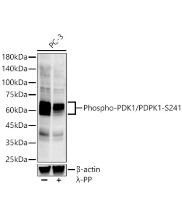 Phospho-PDK1/PDPK1-S241 Rabbit Monoclonal Antibody