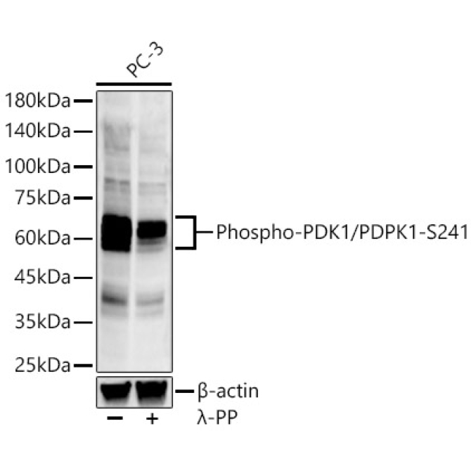 Phospho-PDK1/PDPK1-S241 Rabbit Monoclonal Antibody