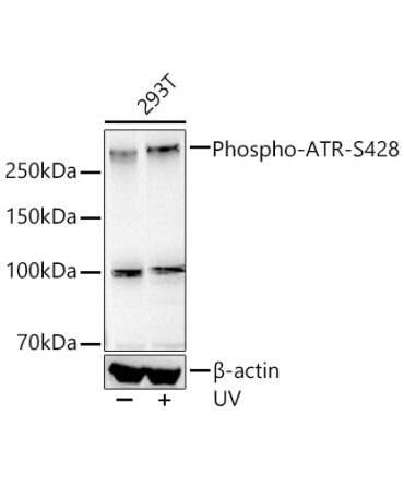 Phospho-ATR-S428 Rabbit Monoclonal Antibody