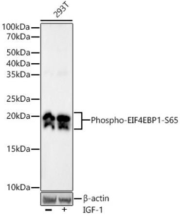 Phospho-eIF4EBP1-S65 Rabbit Monoclonal Antibody