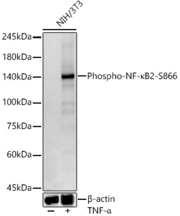 Phospho-NF-?B2-S866 Rabbit Monoclonal Antibody