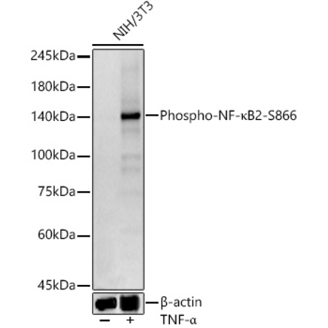 Phospho-NF-?B2-S866 Rabbit Monoclonal Antibody
