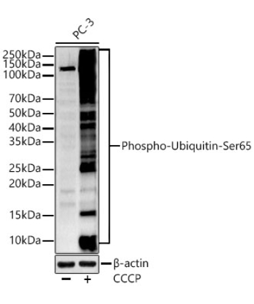 Phospho-Ubiquitin-Ser65 Rabbit Polyclonal Antibody
