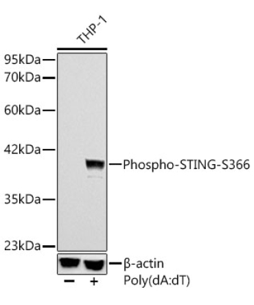 Phospho-STING/TMEM173-S366 Rabbit Monoclonal Antibody